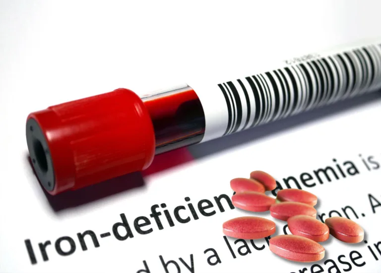 A-Naturopathic-Approach-to-Treating-Iron-Deficiency-Anemia