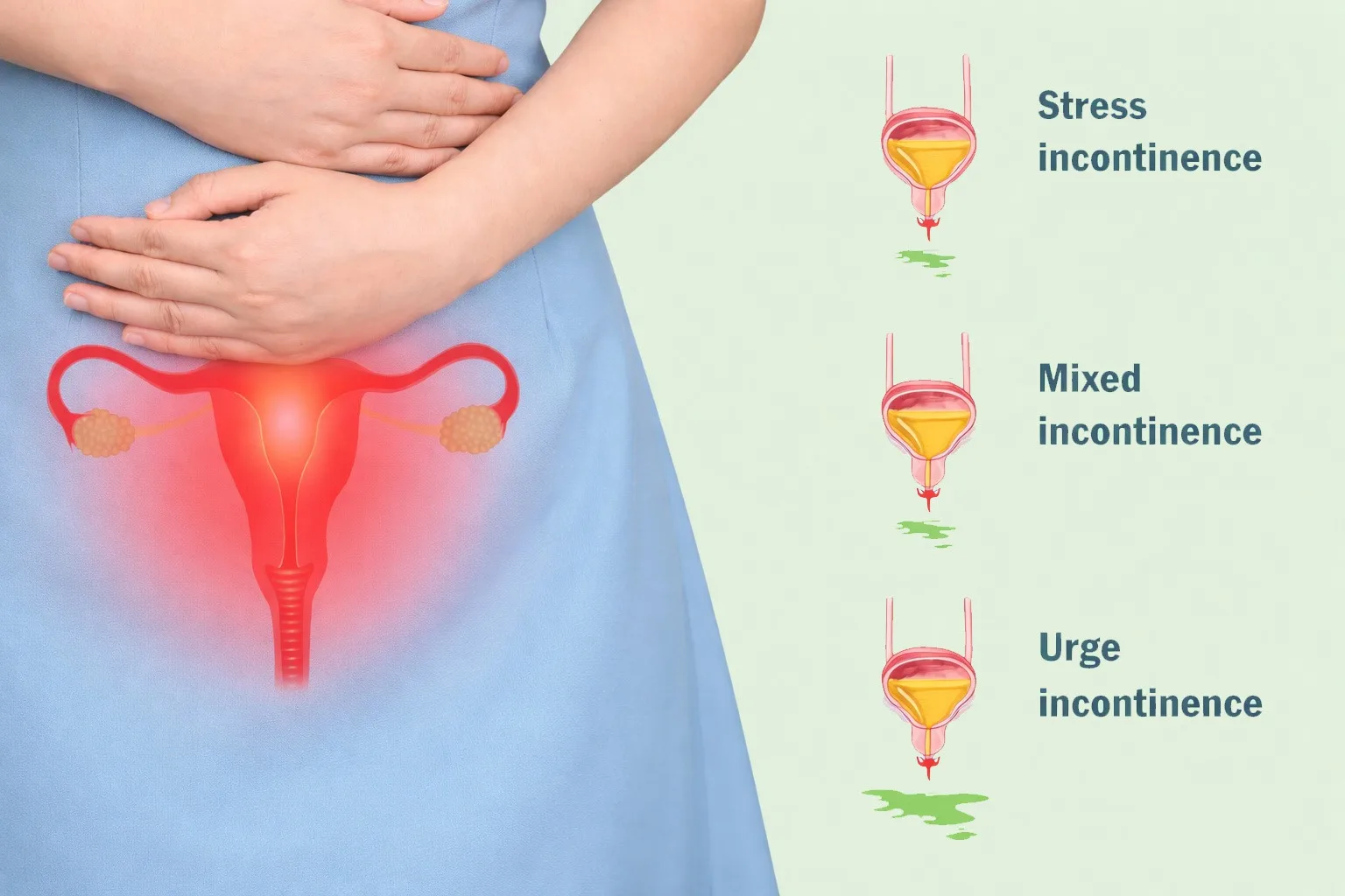 Bladder Leaks in Women: A Complete Guide for Every Life Stage